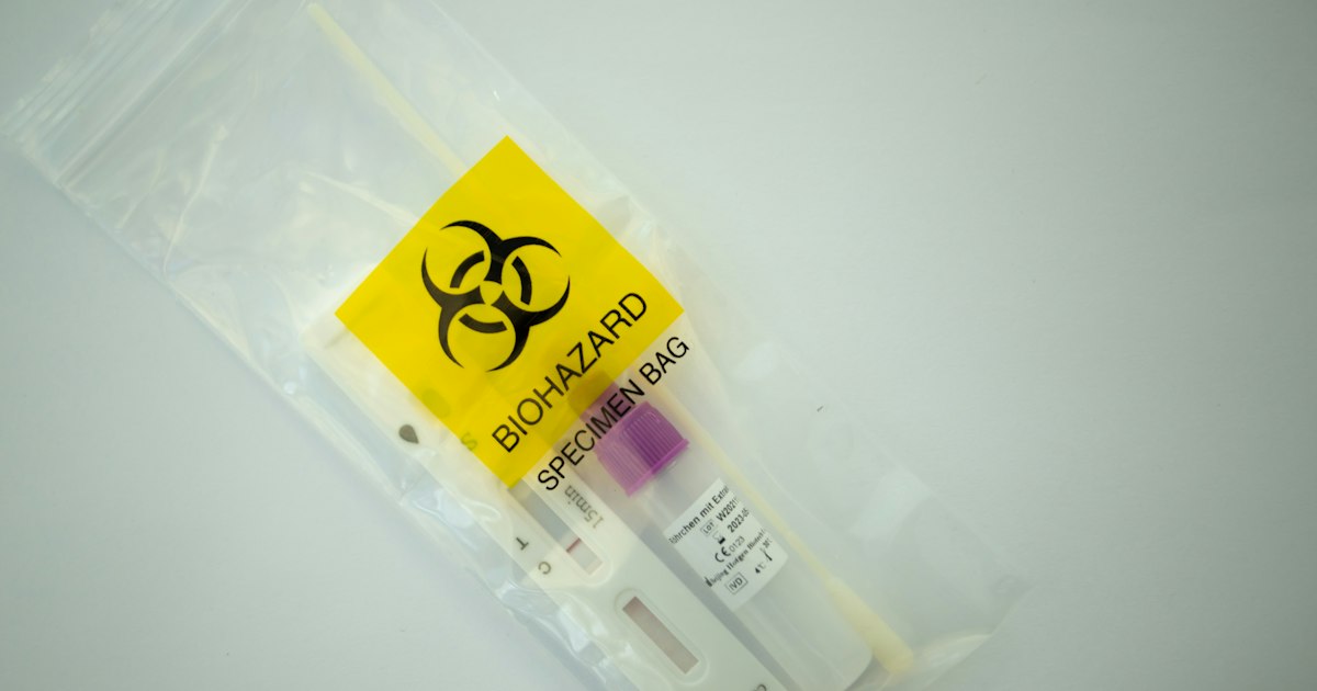Platelets above or below normal: causes in athletes and what to do