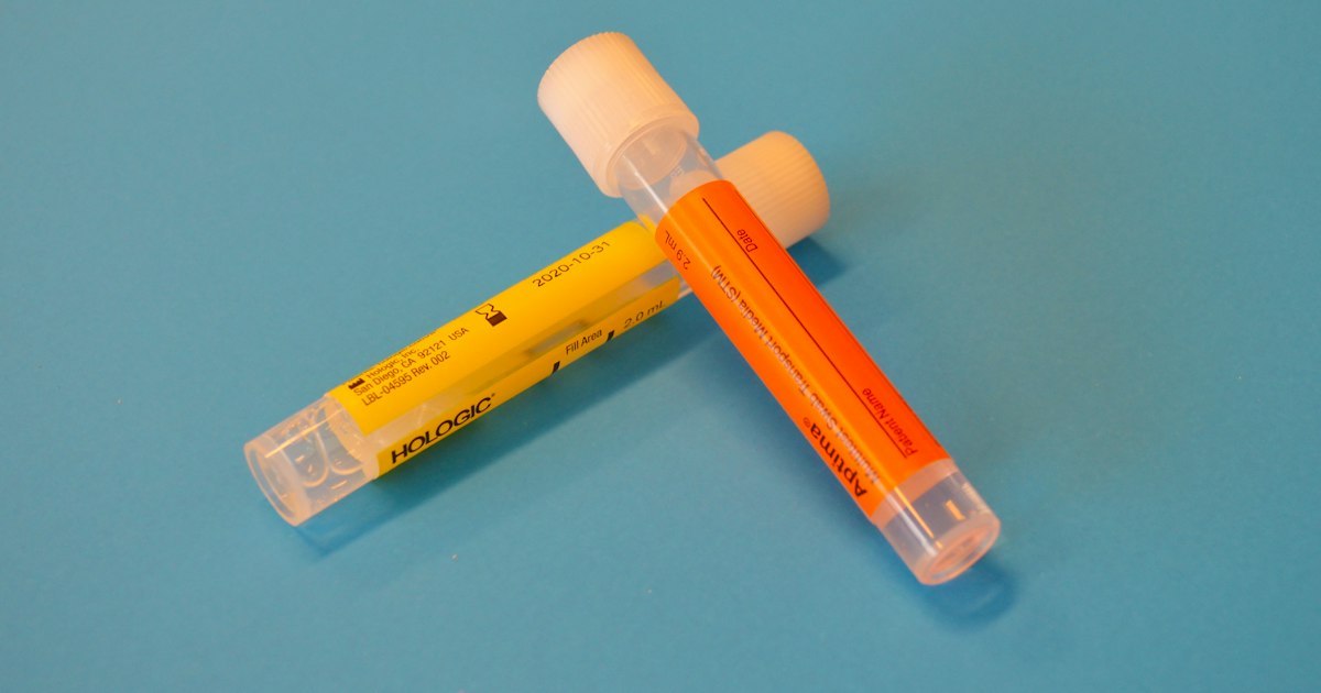 Albumin: what the test shows and why it matters for athletes